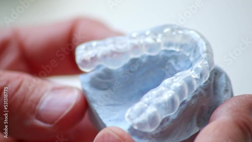 Orthodontist holding tooth imprint and dental splint with his hands for dental protection against bruxism and gnash protection as dentistry surgery for braces against underbite or crossbite by plaster photo