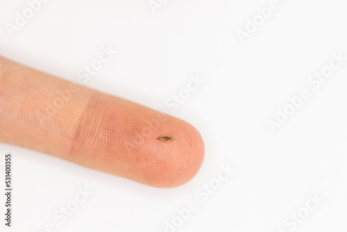 A human louse on a finger when lice was discovered in a child's hair