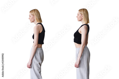 Woman with slouch and straight posture photo
