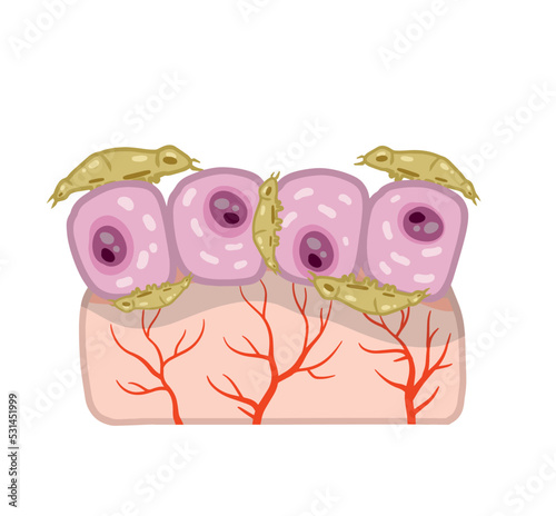 Subcutaneous tick. Skin parasite. Beetles on human epidermis. Harmful insects are carriers of disease demodecosis. Flat cartoon illustration