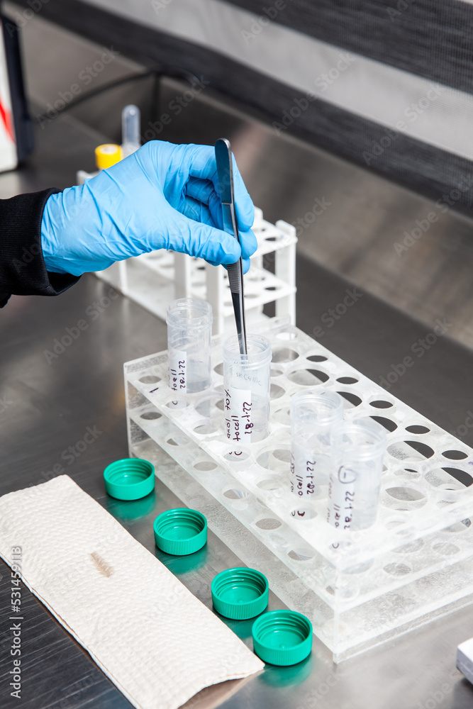 Scientist preparing slides for karyotipe and fluorescence in situ hybridization - FISH in the laboratory. Acute lymphocytic leukemia.  Translocation 4;11.