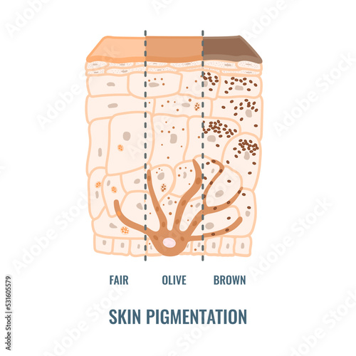 Melanin content and distribution in different skin phototypes. Pigmentation mechanism in dark, olive and light skin. Epidermis cross-section infographic medical diagram. Vector illustration.