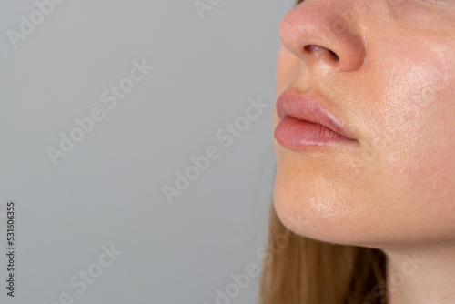 lips push up close up view after lip augmentation procedure with fillers, increase lips hyaluronic acid, visible place of needle injection marks, swelling after cosmetic procedure, cosmetician