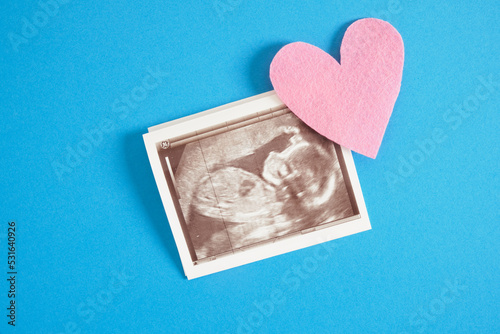 Ultrasound picture pregnant baby photo and envelope on blue background