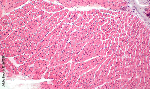 Light micrograph of a section through skeletal muscle. Muscle fibre fascicles. Haematoxylin end eosin stain. Magnification: x200 photo