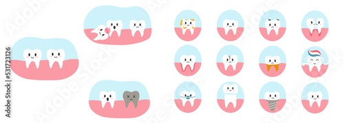 Set of teeth characters in cartoon flat style. Vector illustration of various dental diseases and tooth condition, as caries, crack, split, implant, gingivitis, wisdom tooth for brochure, banner photo