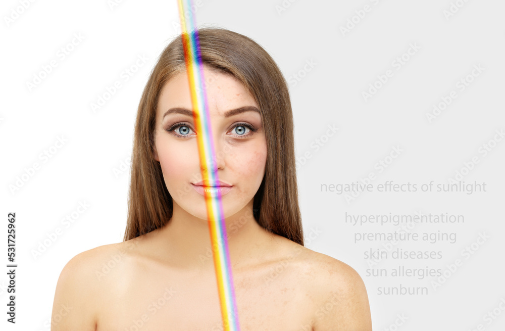 negative effects of sunlight( hyperpigmentation, premature aging,. sun