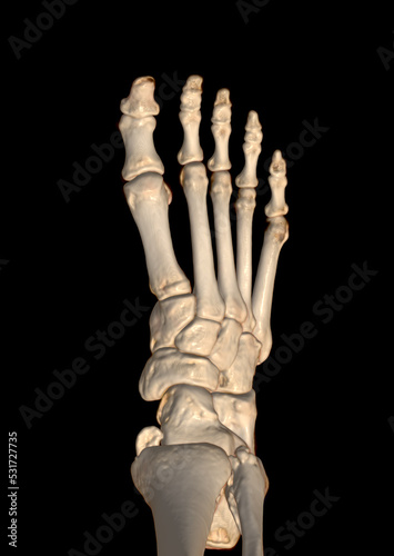 CT Scan ankle and foot .