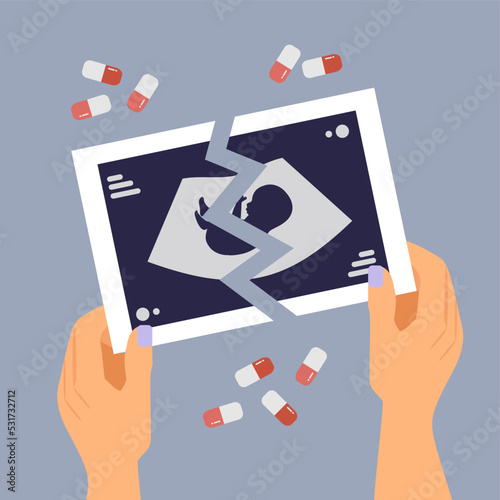 torn shot of ultrasound in hands with pills on background, abortion, miscarriage, pregnant woman, unborn, hospital birth, no children, pills, medical abortion, fetus, embryo, pregnancy, infertility