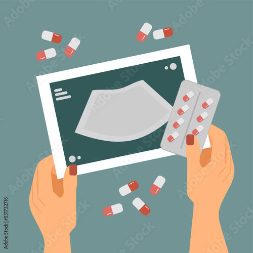 contraception, pills and an ultrasound scan in hand, medical abortion, coitus interruptus, choice of contraceptive method, birth control pills, unwanted pregnancy, protection against genital infection