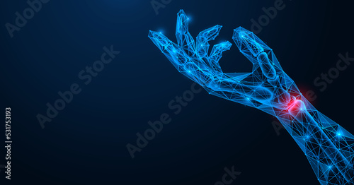 Inflammation and pain in the wrist joint of the hand. Polygonal design of lines and dots. Blue background. photo