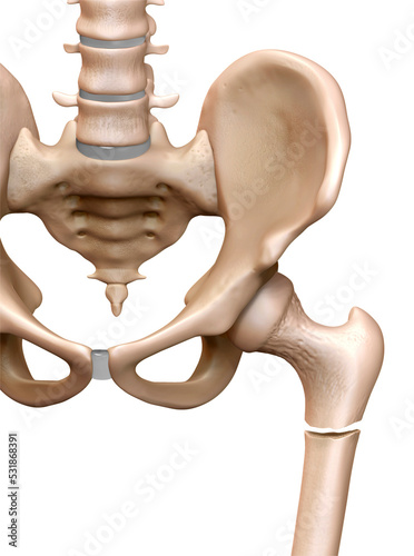 Fractured femur, illustration photo