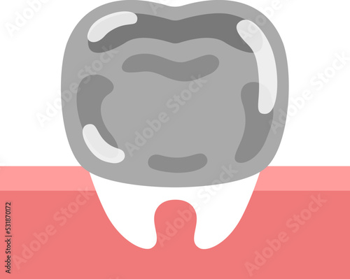 銀歯のイラスト