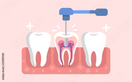 Tooth drill medical dental drill concept. oral hygiene. flat vector illustration design.