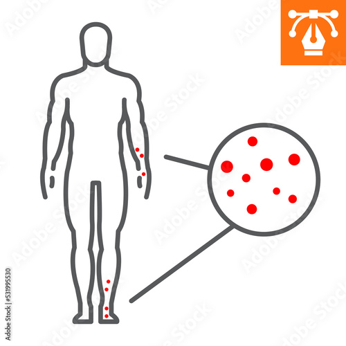 Rash line icon, outline style icon for web site or mobile app, covid and monkeypox, chickenpox vector icon, simple vector illustration, vector graphics with editable strokes.