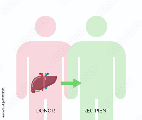 Human organ transplantation concept. Vector illustration of donor and recipient of liver organ