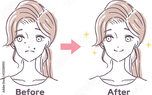 顔のほくろ除去のビフォーアフターイラスト素材　黒子に悩む女性
