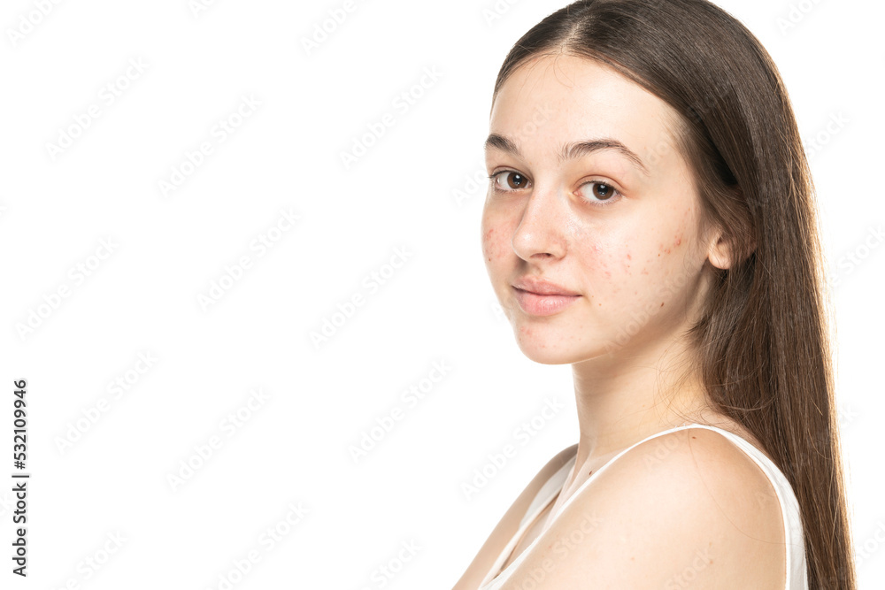 beautiful young smiling women with problematic skin beautiful young smiling women with problematic skin