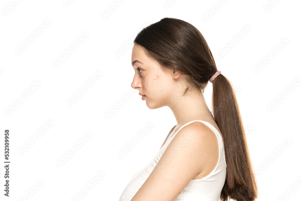 Profile of al young women with problematic skin Profile of al young women with problematic skin