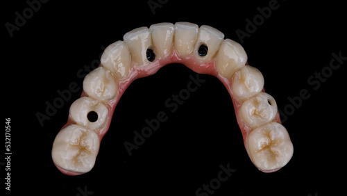 top view of a ceramic prosthesis of the lower jaw on a black background