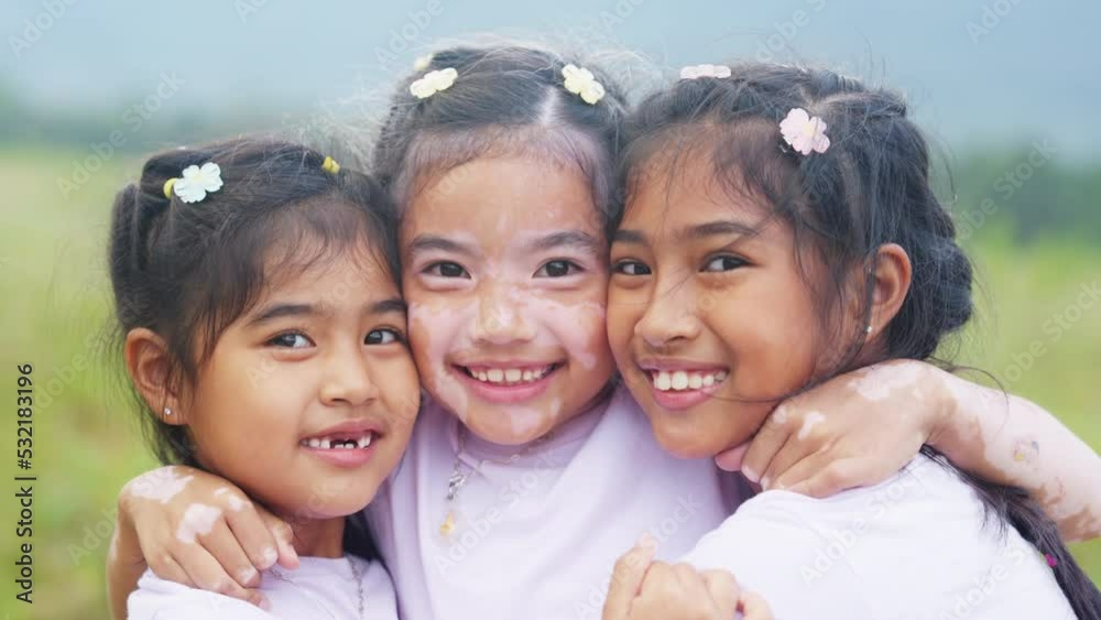 Little cute alpha young albino vitiligo small girl group smile look at camera fun joy hug in meadow field. Melanin face body of asia people gen z kid self love happy diverse of beauty skin care color. Little cute alpha young albino vitiligo small girl group smile look at camera fun joy hug in meadow field. Melanin face body of asia people gen z kid self love happy diverse of beauty skin care color.