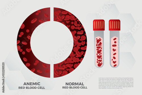 Anemia Iron red blood cell medical vector illustration medical.
