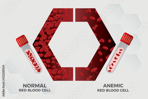 Anemia Iron red blood cell medical vector illustration medical.
