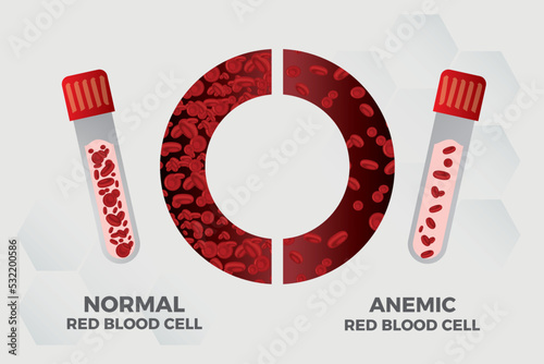 Anemia Iron red blood cell medical vector illustration medical.

