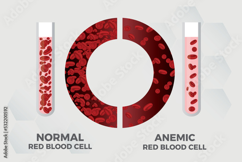 Anemia Iron red blood cell medical vector illustration medical.
