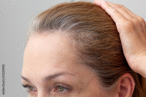 Cropped face of woman holding hand on head showing grey hair