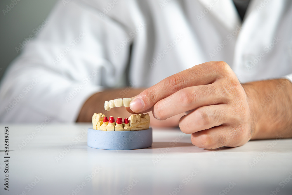 Dentist holding mock mouth Dentist holding mock mouth