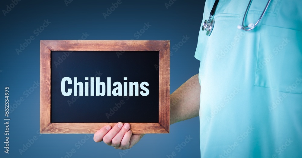 Chilblains. Doctor shows sign/board with wooden frame. Background blue Chilblains. Doctor shows sign/board with wooden frame. Background blue