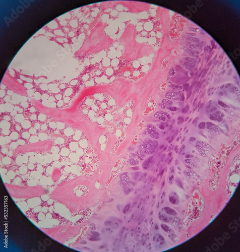 photo of fibro cartlige tissue underr the microscope photo