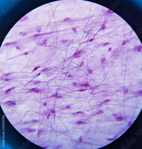 photo of loosen connective tissue underr the microscope photo