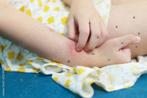 Little girl has skin rash allergy and itchy on her arm from mosquito bite photo