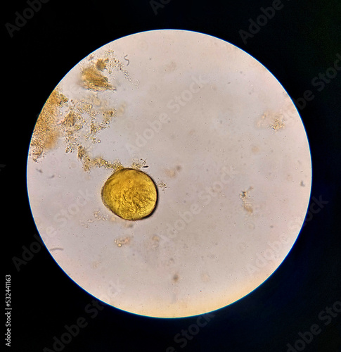 Urbanorium parasite analyzed under a microscope