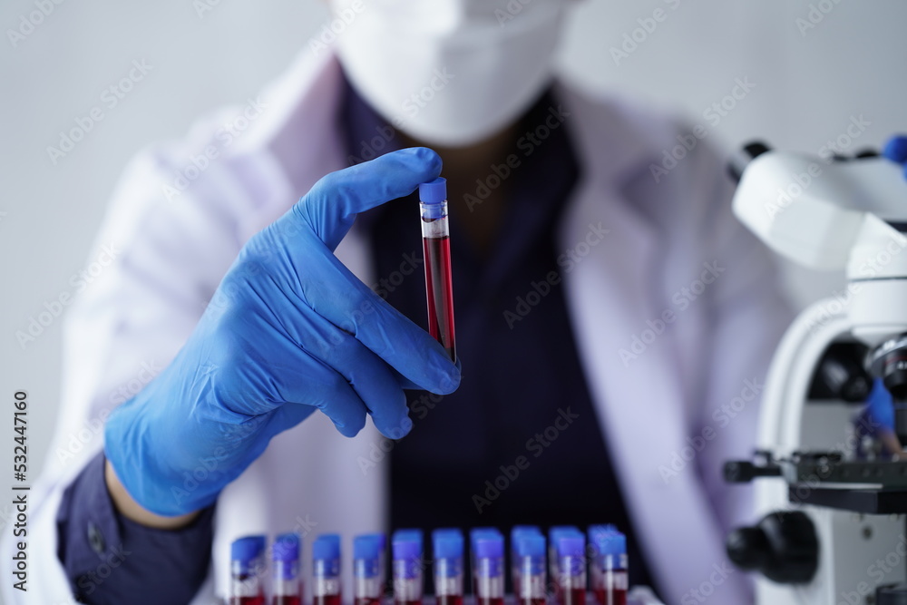 Lab worker preparing test blood for detection of antibodies and infections Corona virus.
