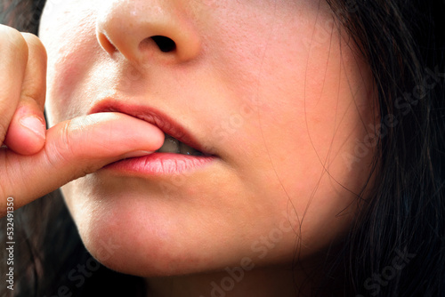 A girl is biting her nail, closeup of the mouth due to stress and anxiety. Onychophagy.