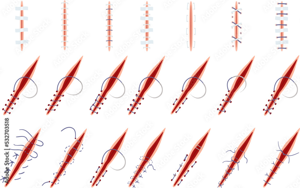 Suture icons set cartoon vector. Wound surgical. Doctor laceration Suture icons set cartoon vector. Wound surgical. Doctor laceration