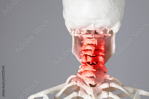 Fotografie Human body upper spine and neck pain zone, atlas vertebrae and cervical vertebra