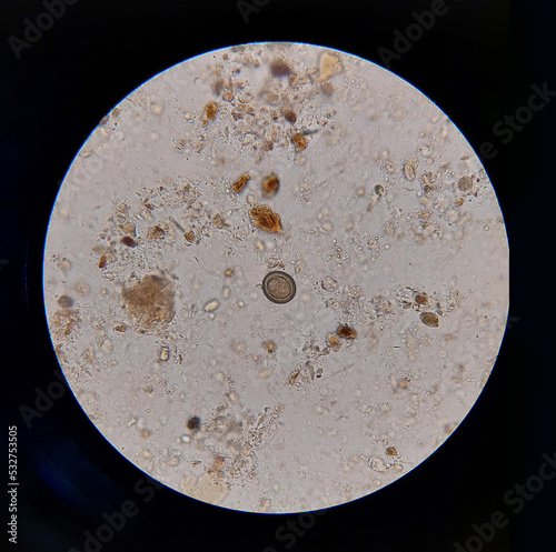 Taenia sp egg microscope  parasitology laboratory photo