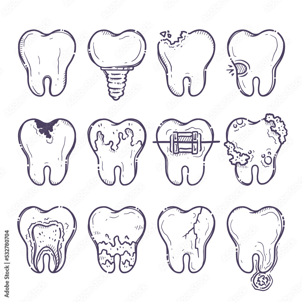 Teeth care treatment collection. Set on the theme of dental medicine for posters, books, leaflets, stickers. Illustrations of teeth with different types of diseases. Vector hand drawn style. Teeth care treatment collection. Set on the theme of dental medicine for posters, books, leaflets, stickers. Illustrations of teeth with different types of diseases. Vector hand drawn style.