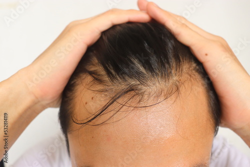 Shampoo for a boys hair loss problem and health and beauty