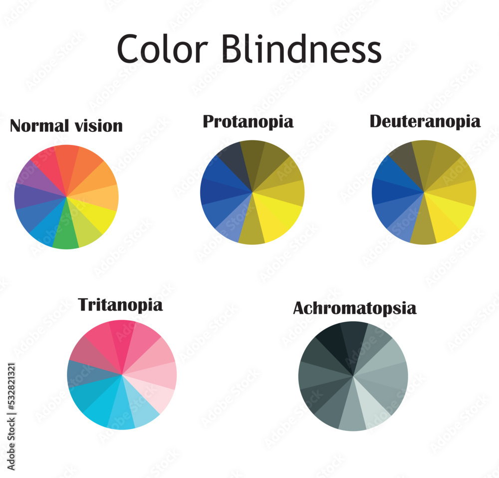 Color Blindness Typs Normal Vision Protanopia Deuteranopia Tritanopia And Achromatopsia 