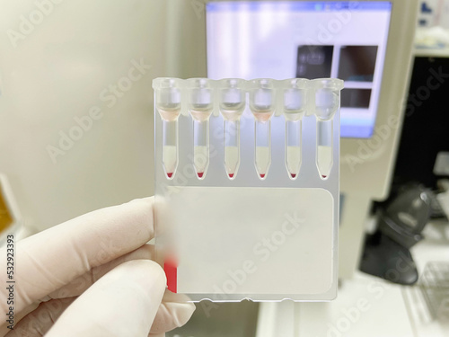 Colume gel in crossmatching testing. photo