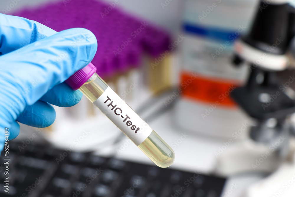 Naklejka premium Urine samples for testing THC in the laboratory