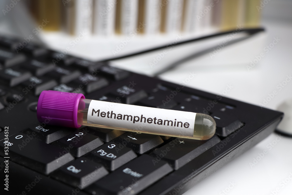 Urine samples for testing Methamphetamine in the laboratory