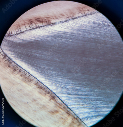 photo of tissue under the microscope photo