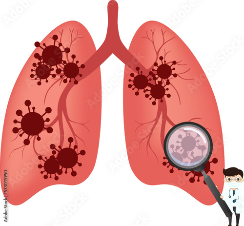 Coronavirus COVID-19. Doctor talks about virus. Infected lungs. Doctor and vaccine and virus.