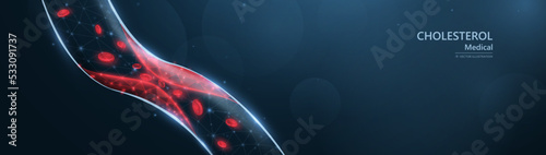 Cholesterol in the blood vessels is made from lines, triangles, low polygon, and particle-style designs. Vector illustration